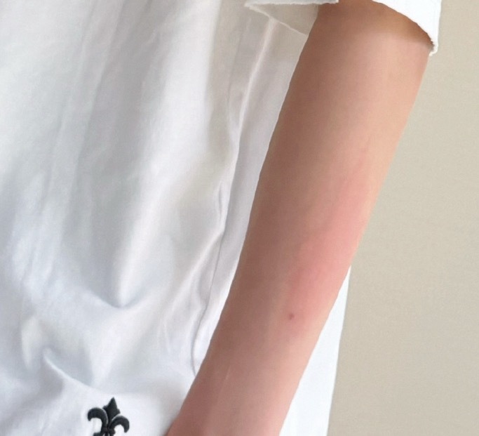 看得出这只🦟是有点毒 
