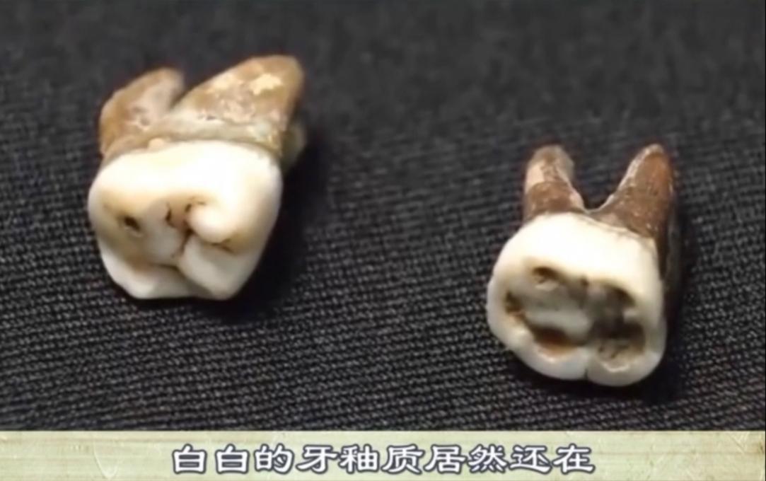 这是大运河博物馆收藏的隋炀帝蛀牙，距今1400多年，白白的牙釉质居然还在。隋炀帝