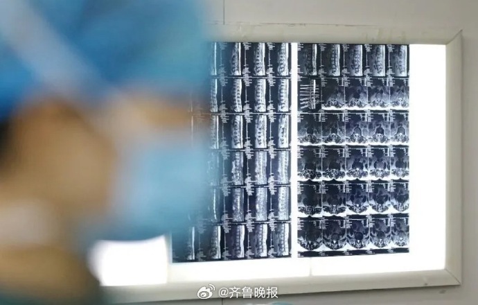 #日常实用大全#【#5种炎症可能变成癌症#】多项流行病学研究表明，炎症与癌症的发