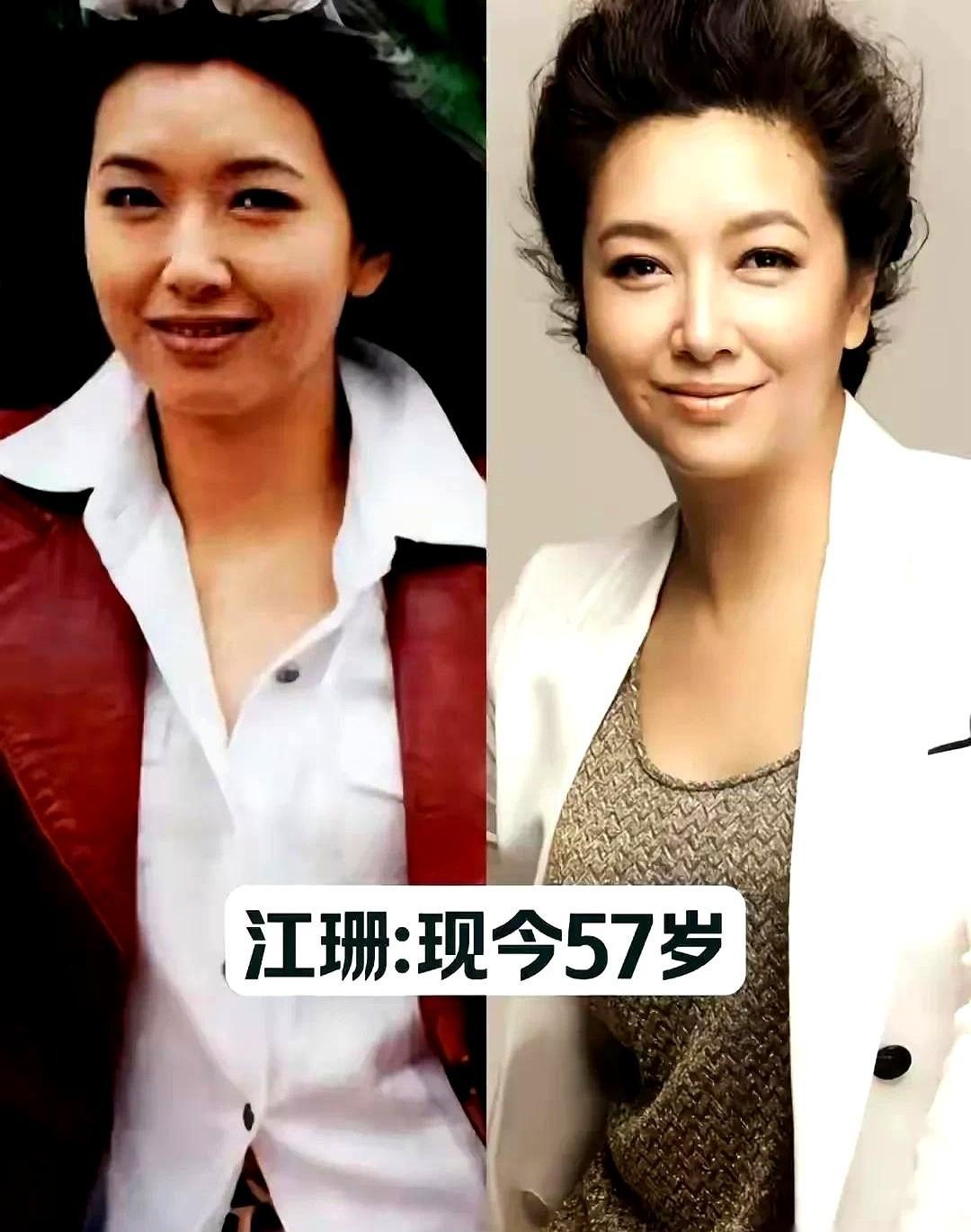 陈数不装嫩，秦岚不喊老，她们只是站着，就让整个镜头安静了。
不是医美能堆出来的美