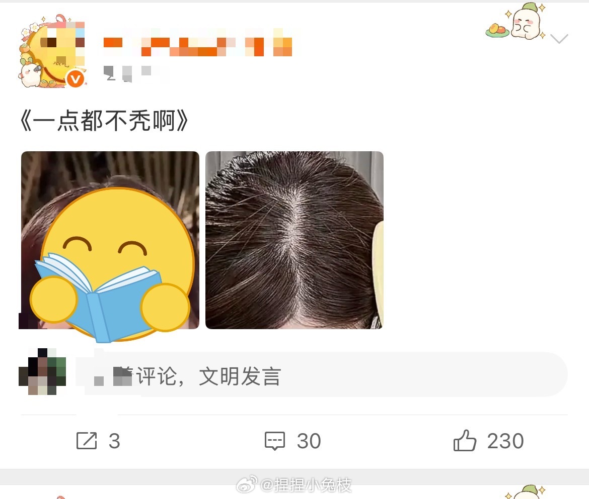 鱼丝挺在意我露的发际线都要研究那么仔细[笑cry] ​​​