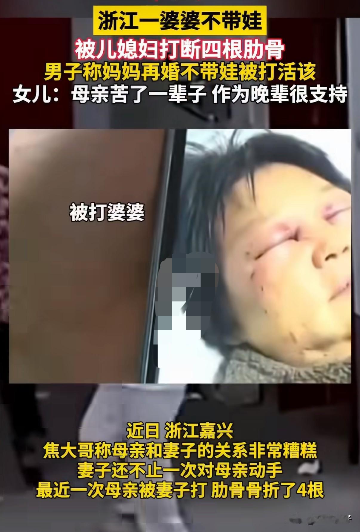 浙江嘉兴年过六旬的婆婆沈大妈，因再婚后没有去安徽帮儿子儿媳带娃，遭儿媳多次殴打，