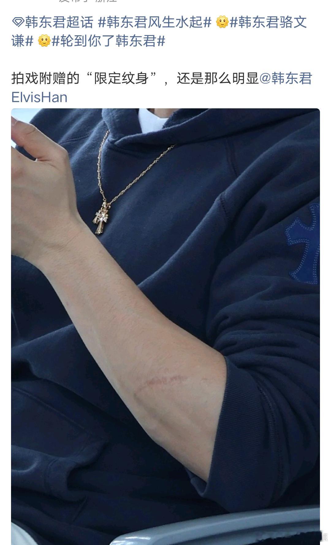 卧槽我不舒服，他这个伤现在还这么明显。 