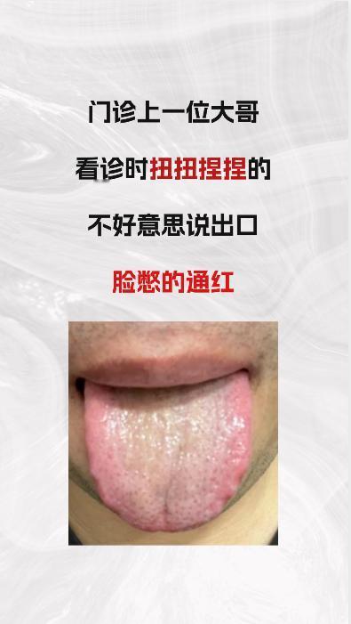 门诊一位大哥，看病的时候扭扭捏捏，脸都憋红了