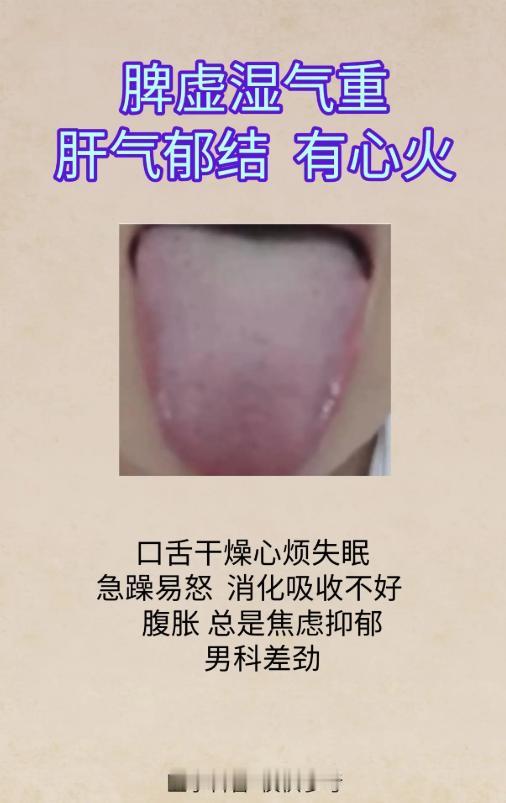 5 种复合舌象，看清肝脾肾虚实