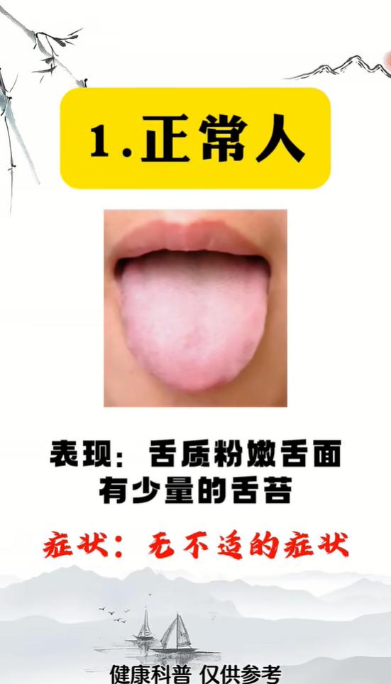 一张舌象对照表，看懂阴虚、肝郁、脾胃寒湿