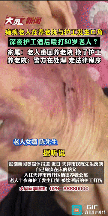 “令人气愤!”天津，一名80岁的瘫痪老人在一养老公寓内，因与护工发生口角，竟被喝