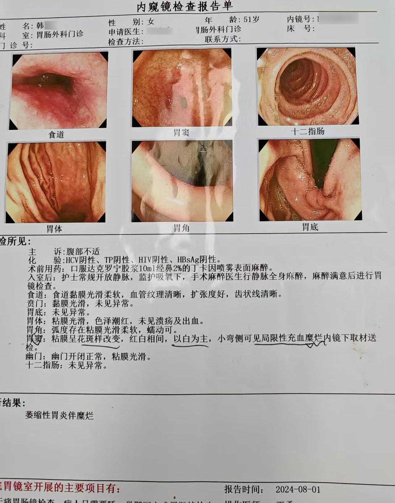 萎缩性胃炎伴肠化，吃中药究竟有没有用？

对于已经确诊“慢性萎缩性胃炎伴肠化”的