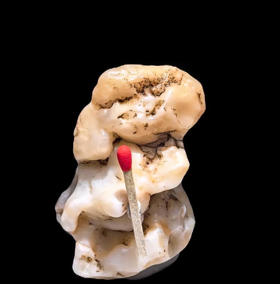 买火柴的小女孩