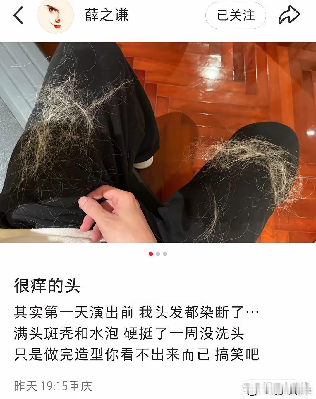 薛之谦满头斑秃和水泡4月8日，歌手薛之谦在社交平台发文，并晒出一组照片，透露第一