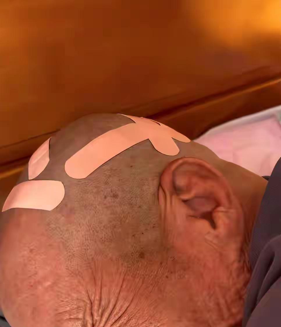 近日，天津一大爷花10元剃头，结果满头都是伤口，回家女儿刘女士看到后，原本想找店