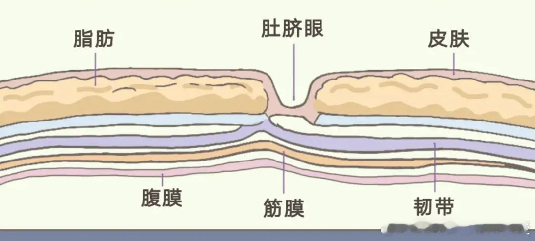#肚脐是腹壁最薄的地方#肚脐眼后方紧挨着腹膜，这块地方是比腹部其他部位薄弱一些，