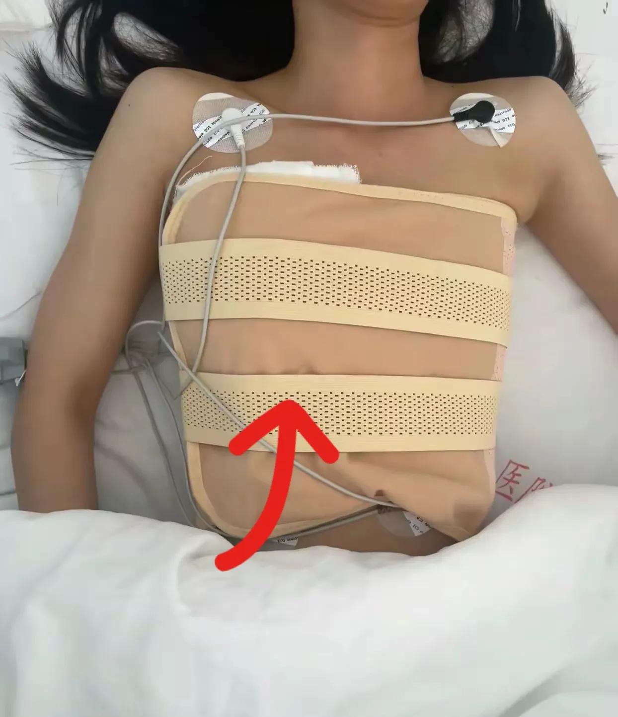 我今年24岁，前段时间被确诊为乳腺癌，一开始我非常非常害怕，我觉得我的生活要毁了
