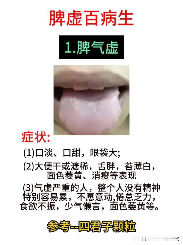 食欲不振，四肢乏力，可能是脾胃虚弱的表现！[左上]
脾虚百病生，中医认为“养脾胃