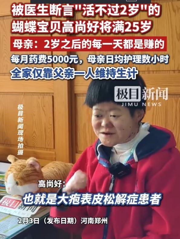 被断言活不过2岁的蝴蝶宝贝将满25岁 除了需要很多钱，还需要很多的爱啊 