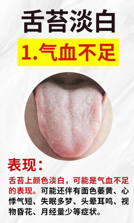 从舌苔看健康：5 种舌象对应不同身体状况