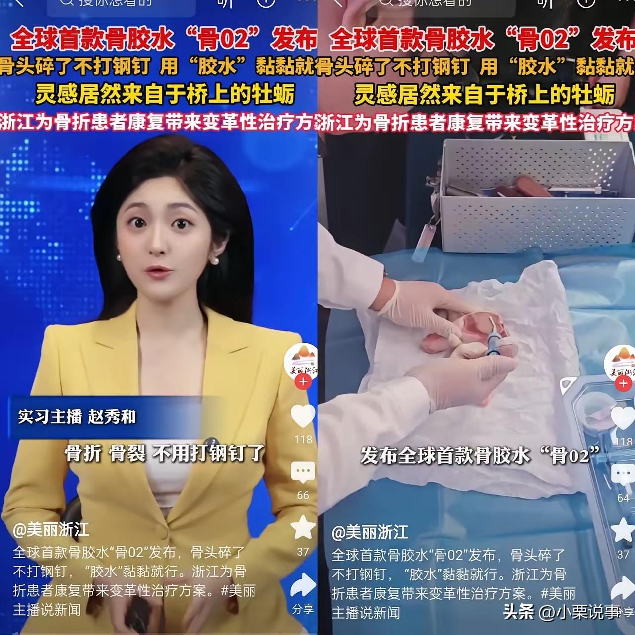 这下出名了，不仅中国，连全世界都要知道了。万万没想到，浙江邵逸夫医院研发出了全球