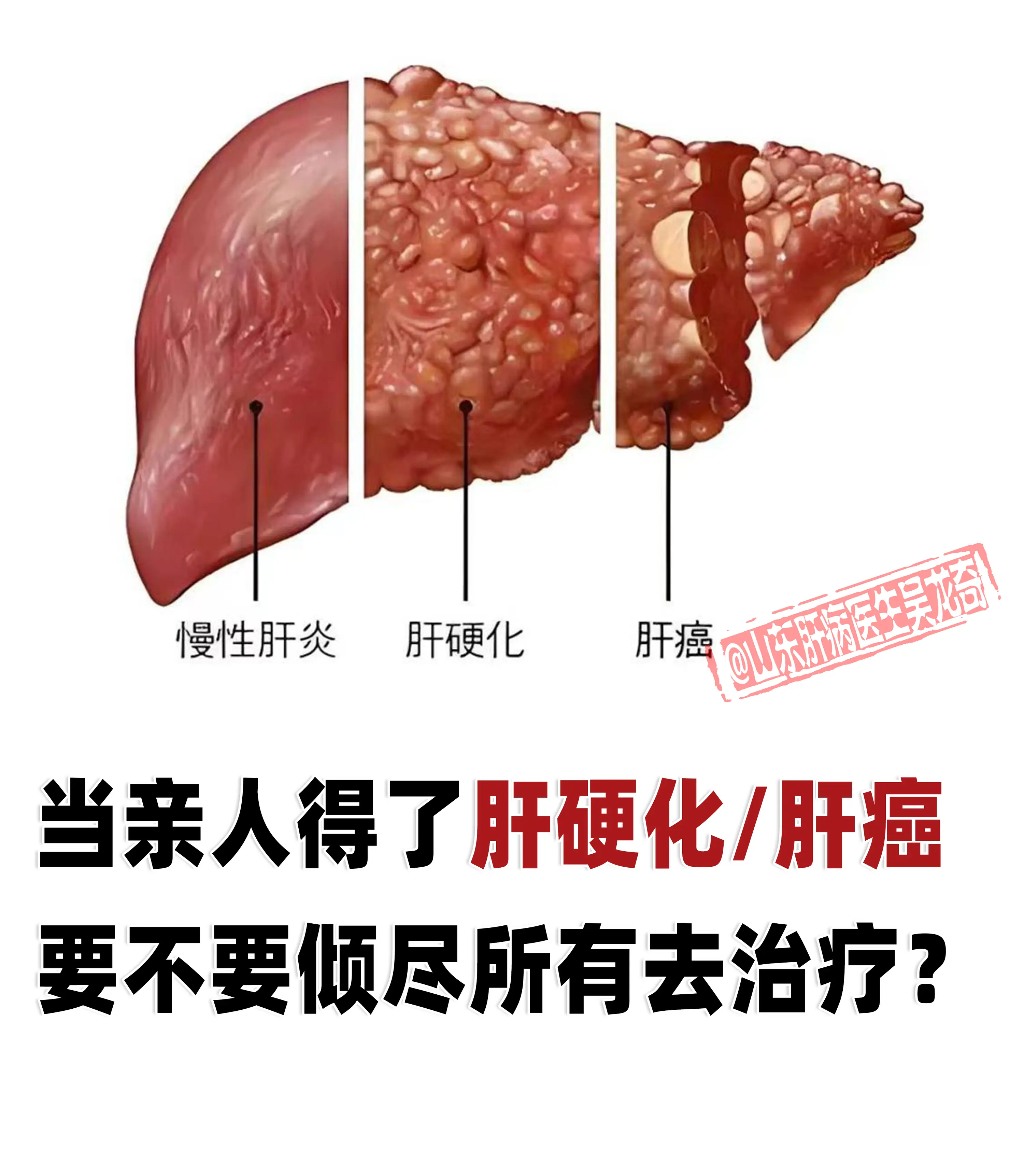 从医学角度看，如果病情处于早期，治疗有较大的希望延长生命、提高生活质量...