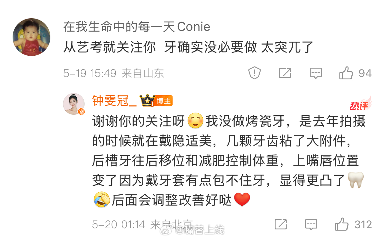 钟雯冠回应上镜牙齿争议绝密较量看《绝密较量》时被钟雯冠演技吸引，却有人揪着她牙齿