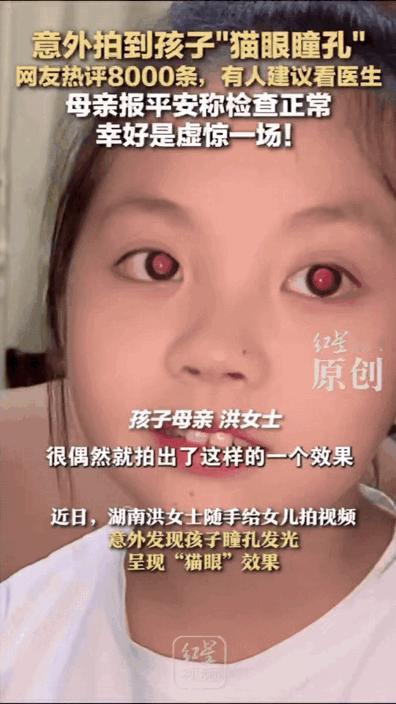 “彻底解释不清了！”湖南，一女子随手给女儿拍视频，竟然发现孩子的眼睛是“猫眼瞳孔