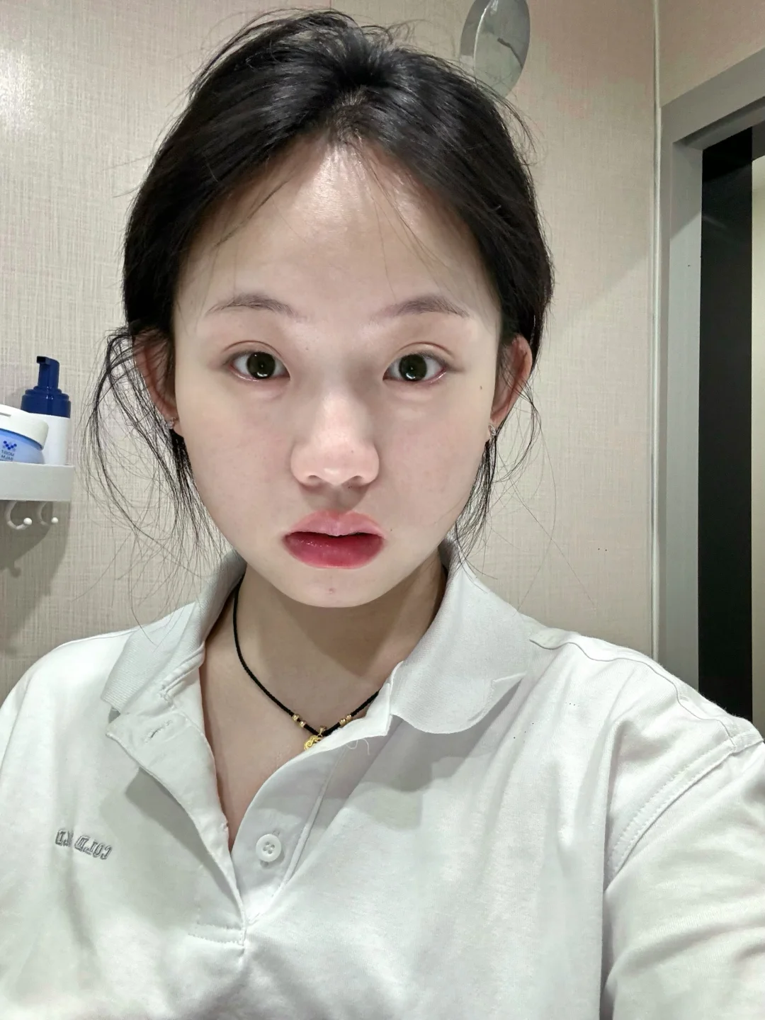 20出头就长斑......怎么搞啊