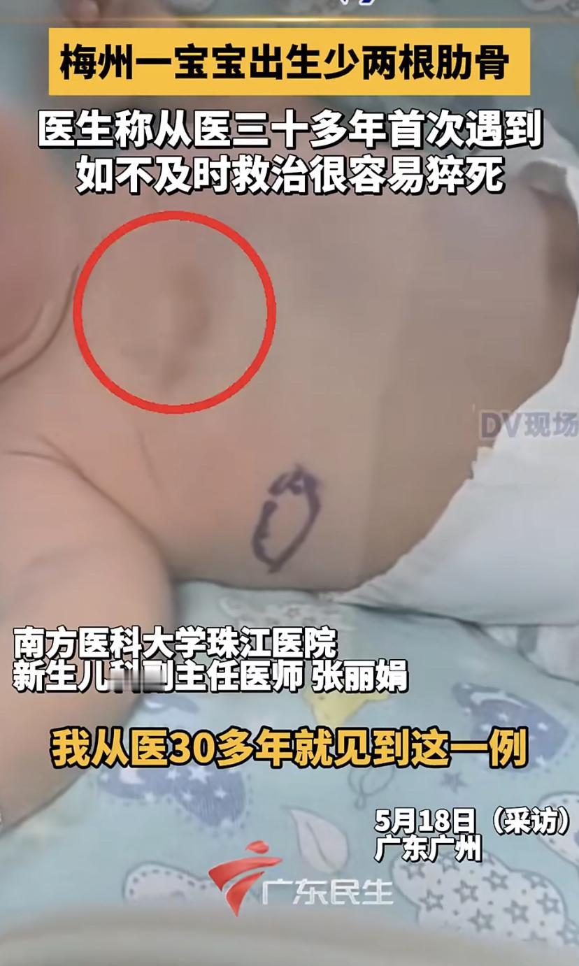 真是医学奇迹!
广东一个新生宝宝，刚出生就没法正常呼吸，急坏了家人。一查才发现，