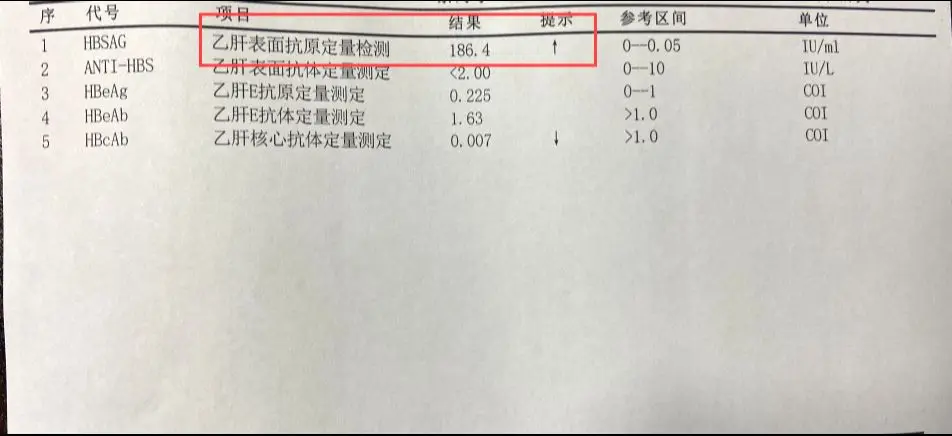 1.坚持抗病毒治疗：根据我国最新版防治指南，只要慢乙肝患者达到标准就要...