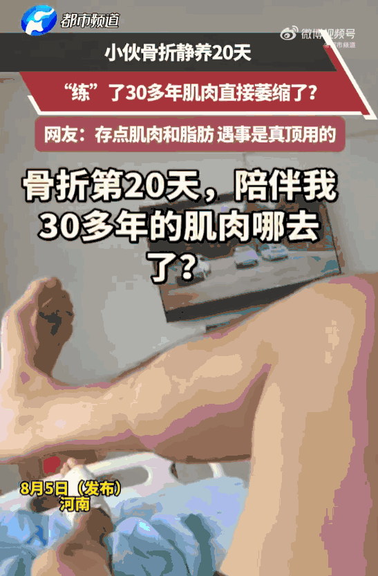 万万没想到！河南一小伙骨折后躺床静养，不料短短20天，练了30年的精壮小腿竟萎缩