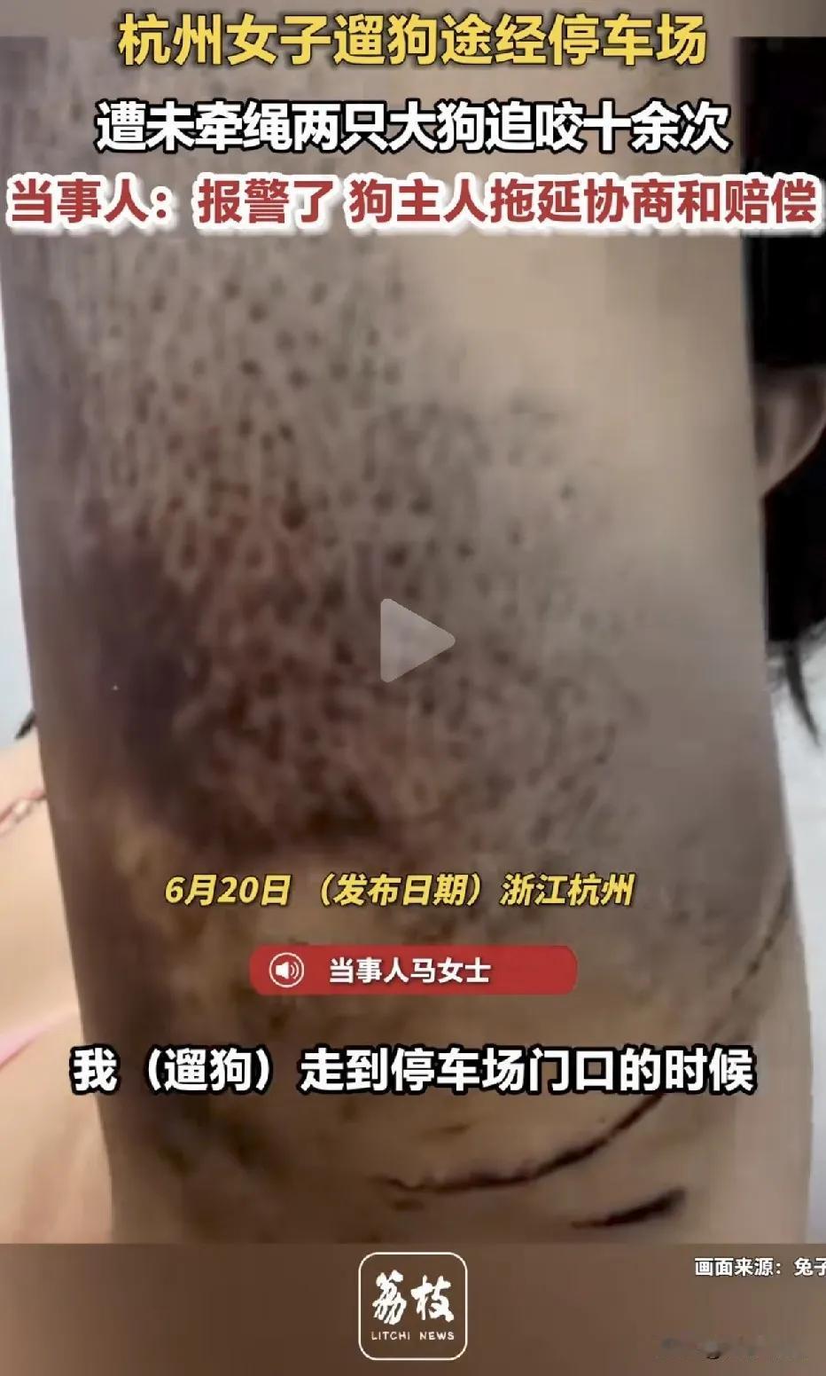 浙江杭州，一名女子在停车场内正常行走时，突然遭到两只未牵绳的大型犬疯狂追咬十余次