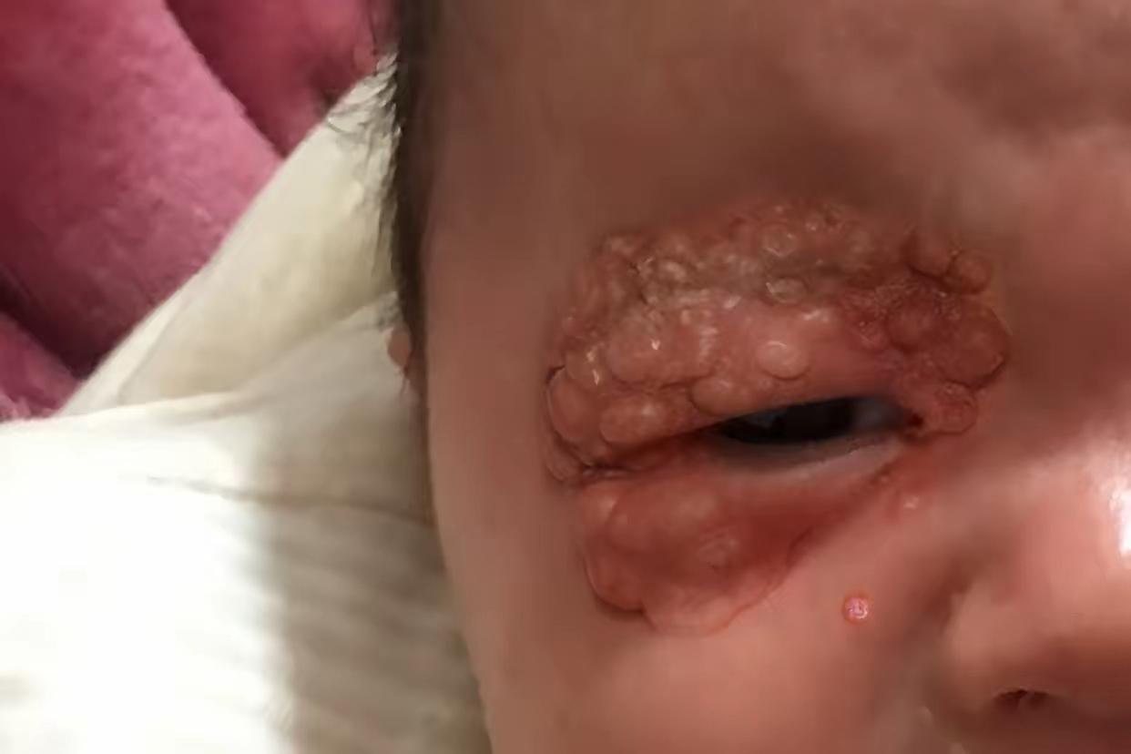 父母全阴，公婆全阳，艾滋通过细小伤口唾液也会传播。