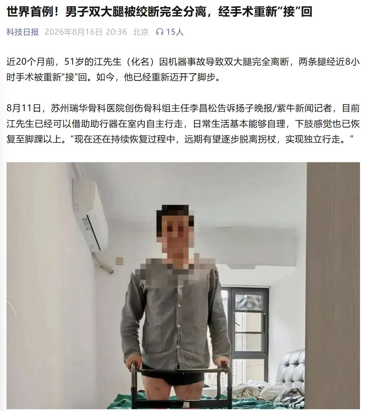 图片上的男子江先生，是世界首例！双大腿被绞断完全分离，经手术重新"接"回的医疗案