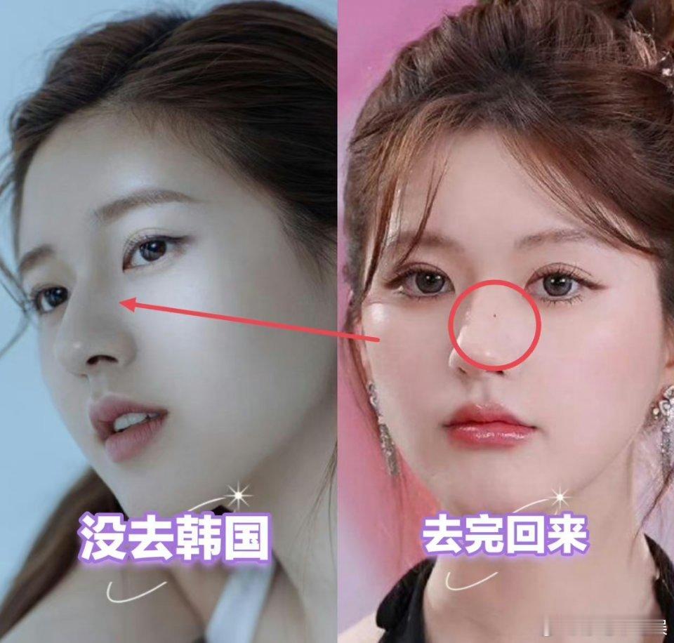 赵露思这变化不显眼但不代表没有 ​​​