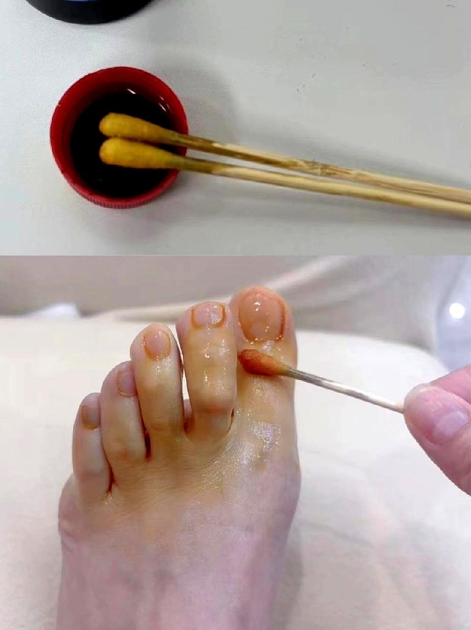 “今天别让我脱鞋。”电梯门刚开时就开始打鼓。
去朋友家、进瑜伽馆、体检换鞋那一刻