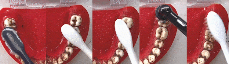 #你多久换一次电动牙刷头#理论上说要3个月更换一次的，刷头是消耗品，用久了会出现