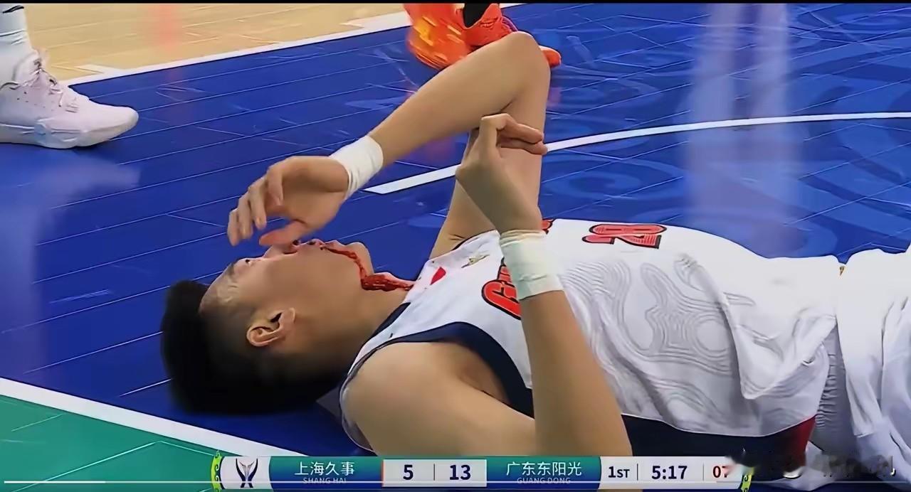 王少杰血染球场令人心疼！请古德温点评不如王少杰现身说法效果更好！
看着王少杰倒在