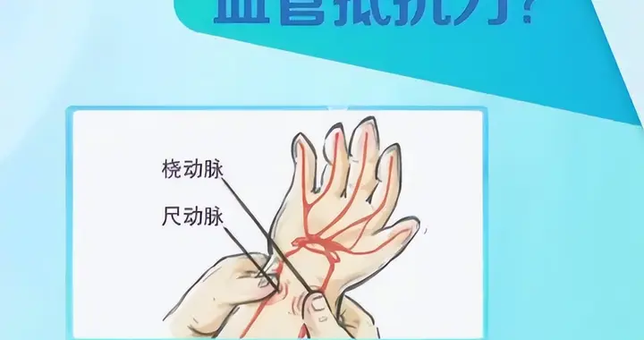 为什么有些人的血管容易堵？一个动作自测血管抵抗力