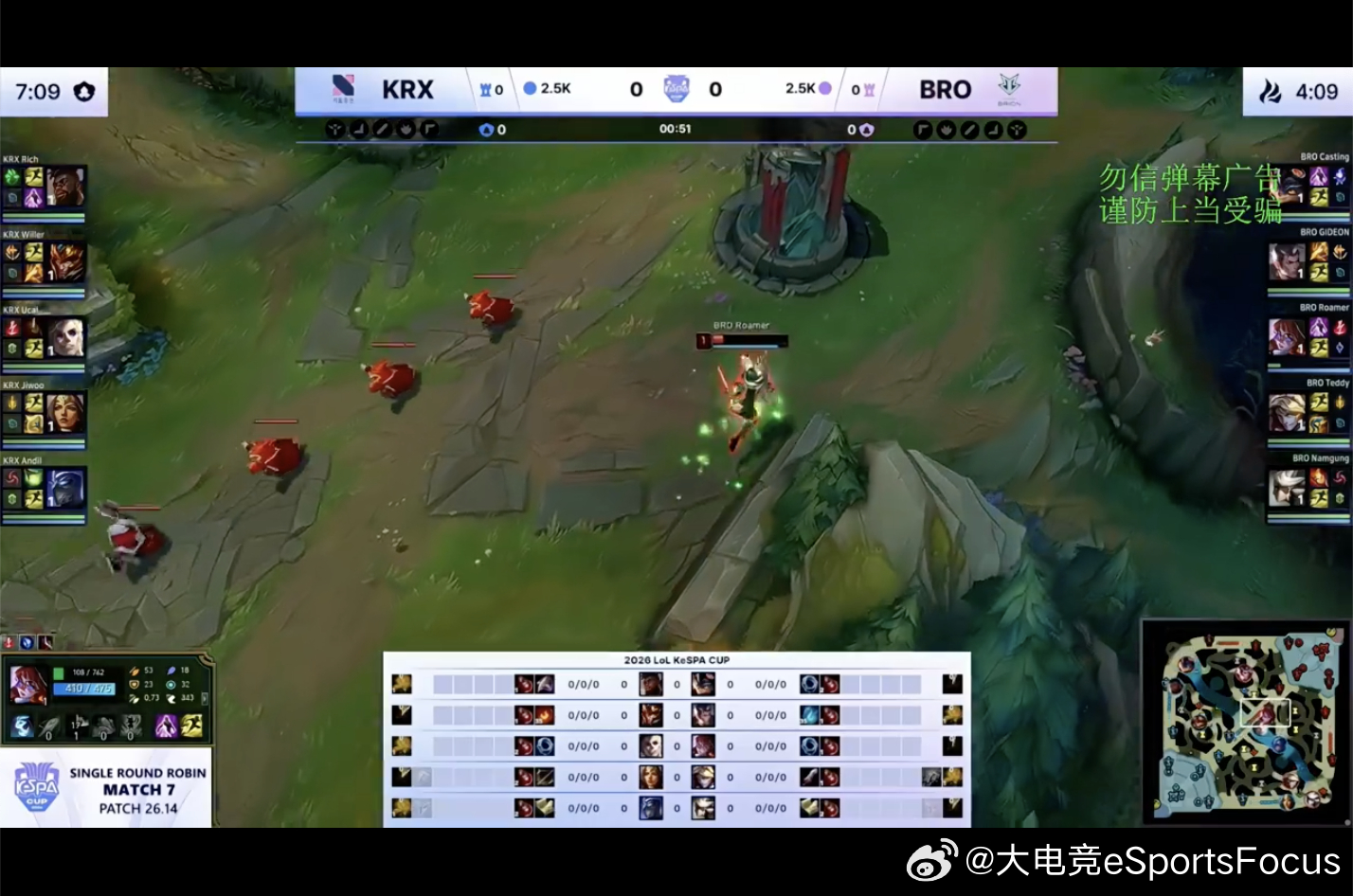 【2026KeSPA杯D-1 BRO vs  KRX】本场BP2026KeSPA