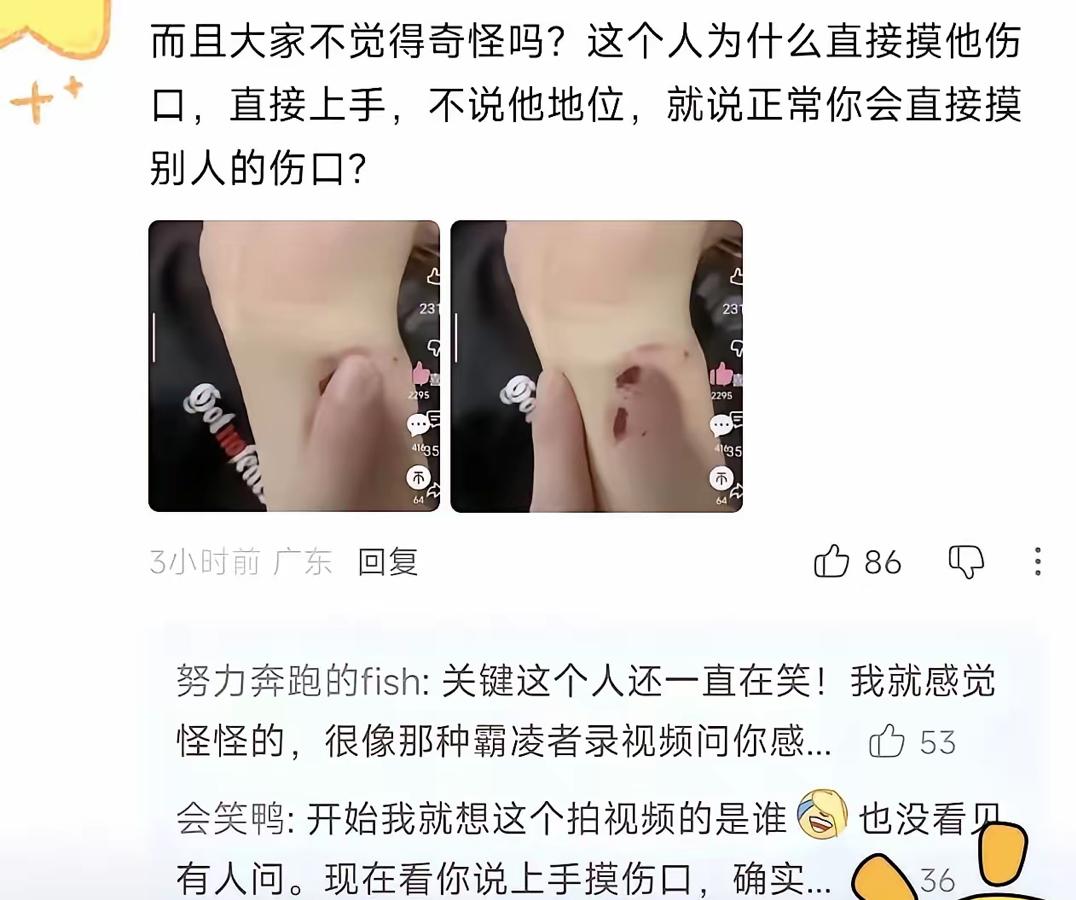 谁这么狠心？孙老师遭绊倒、伤口被压，认真做事咋就这么难

刷到孙老师的遭遇，真的