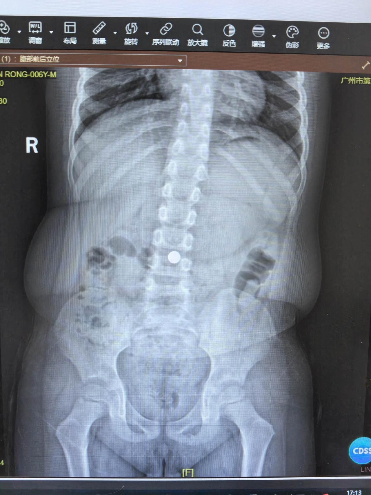 你们猜猜

这个小家伙

把什么吃到肚子里去了？