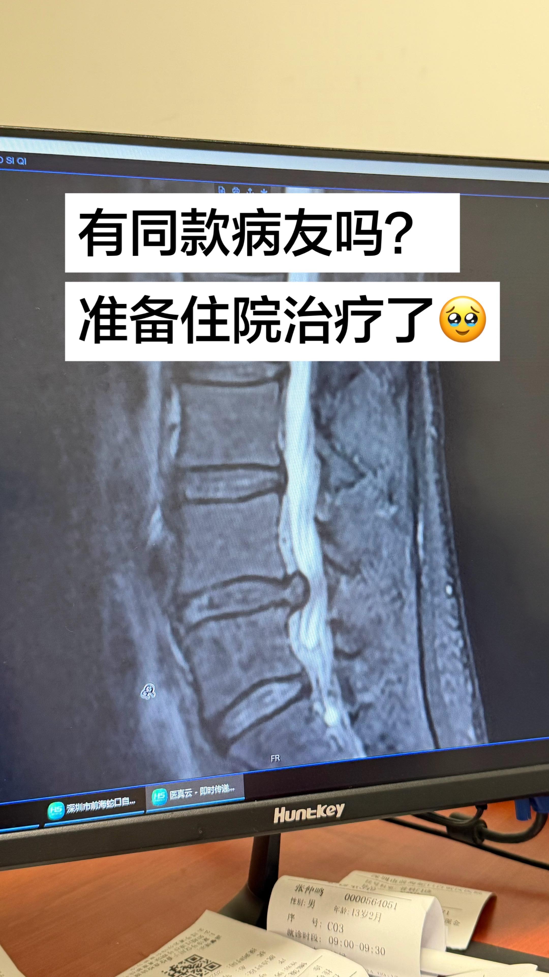 不想手术🥹。