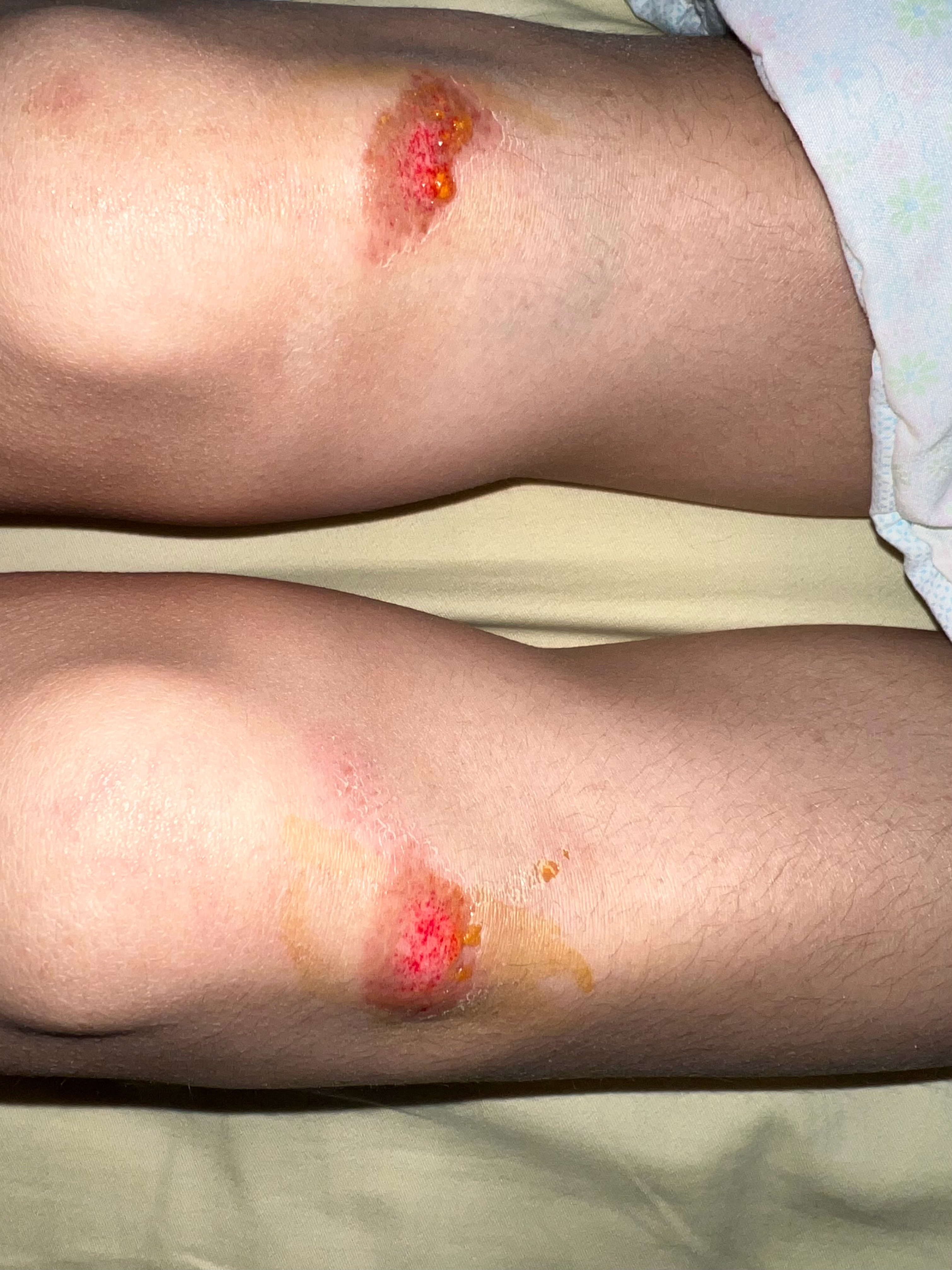 运气简直爆表[淡淡的] ​​​