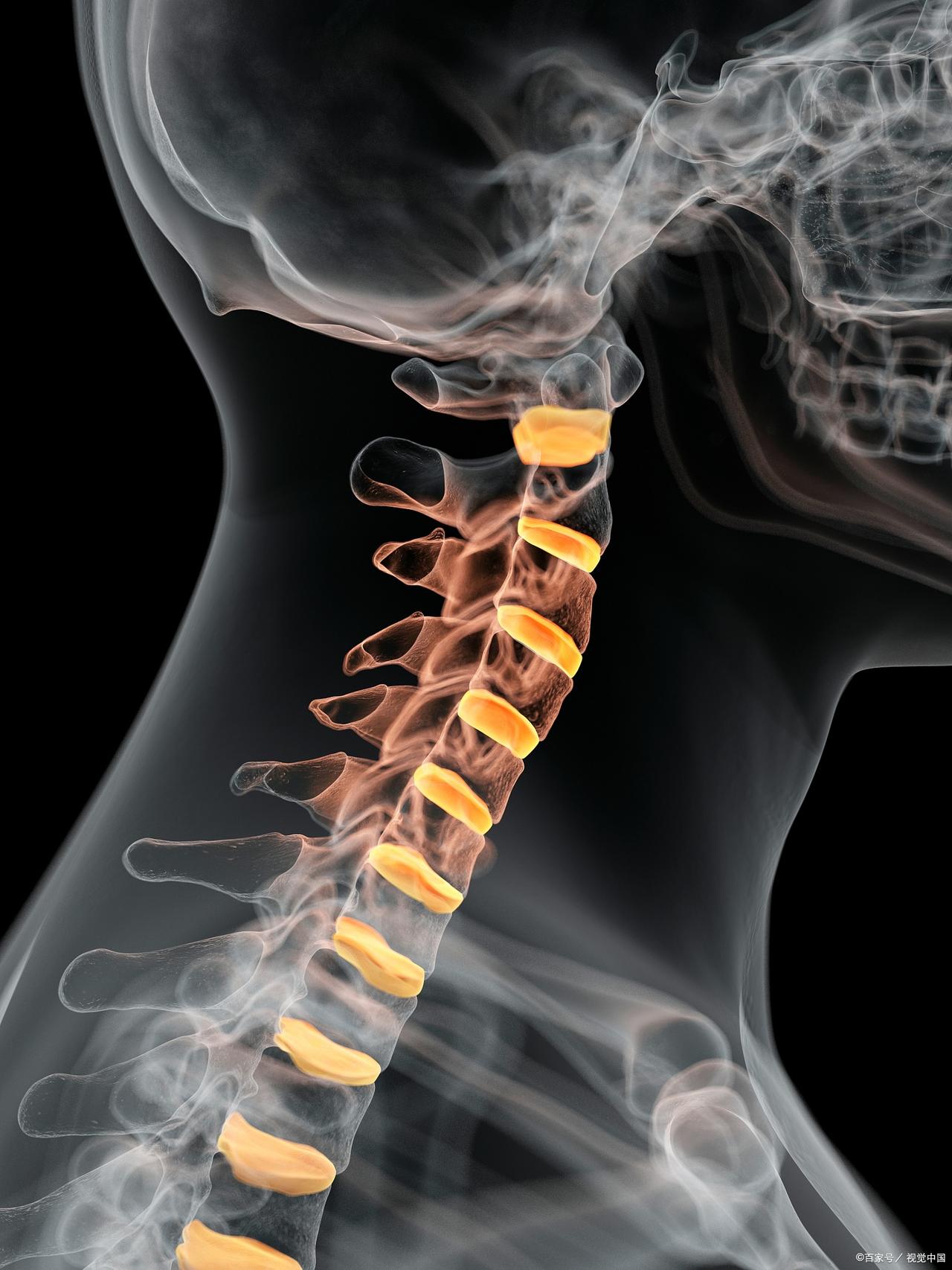 这该死的颈椎病，严重影响了我的工作和生活，我实在不知如何是好了。

颈椎病发作至