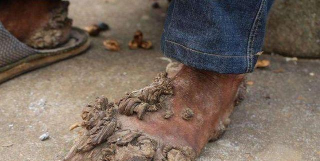 1992年一天深夜，湖南小伙刘忠文突然被痛醒！他连忙起身并打开灯查看，不料，眼前