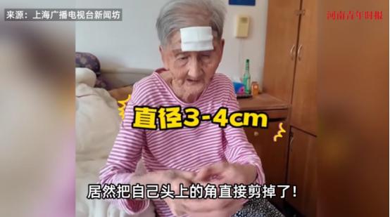 “活久见！”近日，上海，一98岁高龄的老太因为头上长了一个3公分的“犄角”，老太