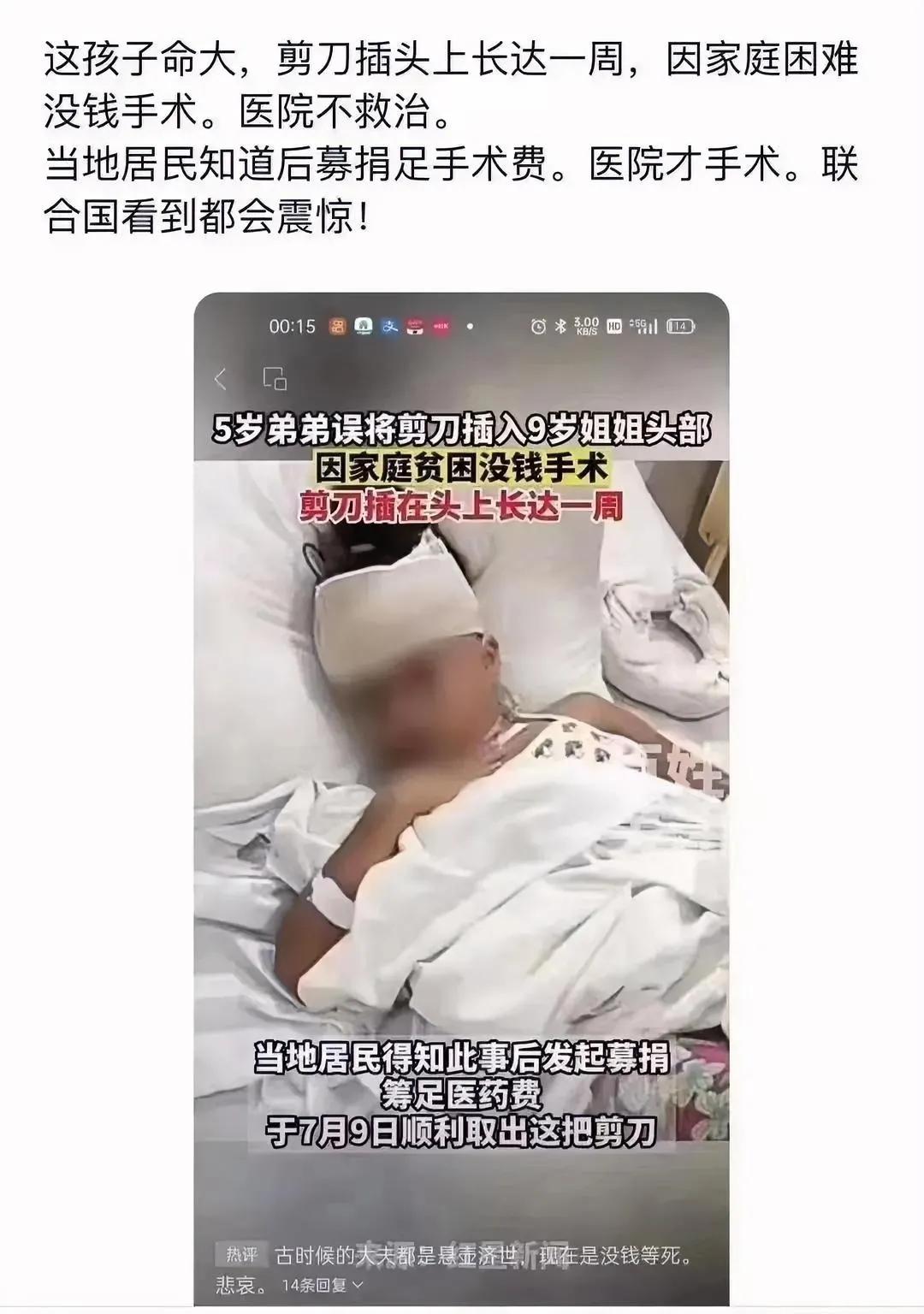 9岁女孩头上被弟弟误插剪刀，长达一周没有做手术，当地居民募捐后才顺利做手术，取出