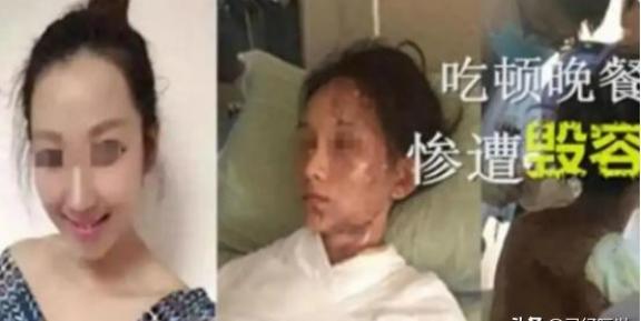 “这就是嘴欠的下场！”2015年8月，浙江一女子吃火锅时叫服务员加汤，因顾客多服