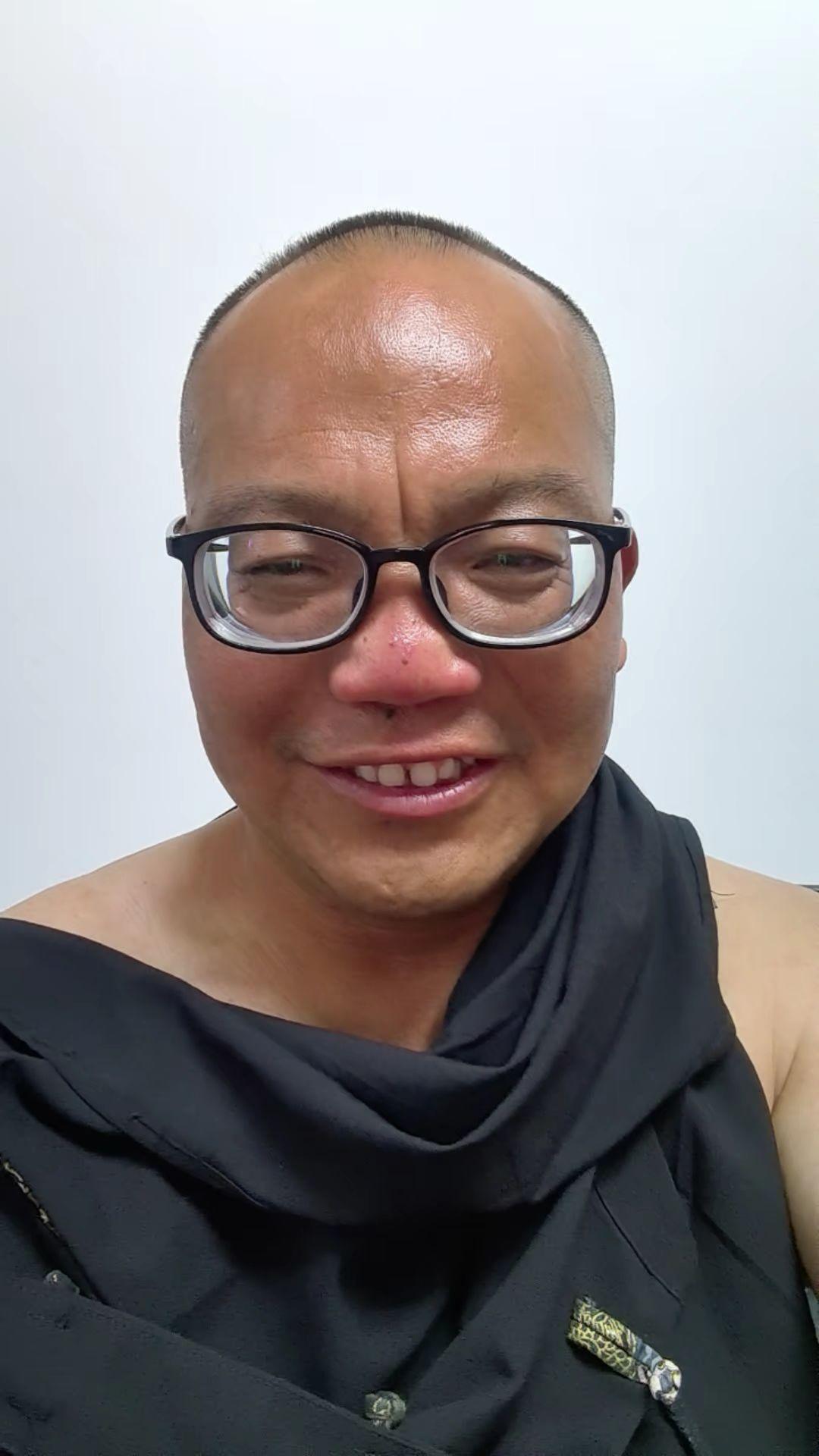 给大家澄清一下，我鼻子下面是一个痦子，不是鼻子疙疤🤭🤭🤭