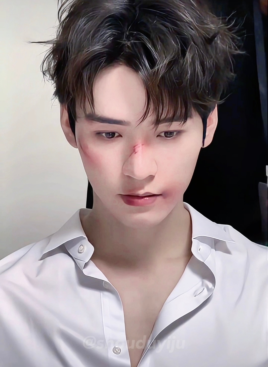 战损小狗🐶 龚俊就这样用无辜的眼神看着我🥹 ​​​