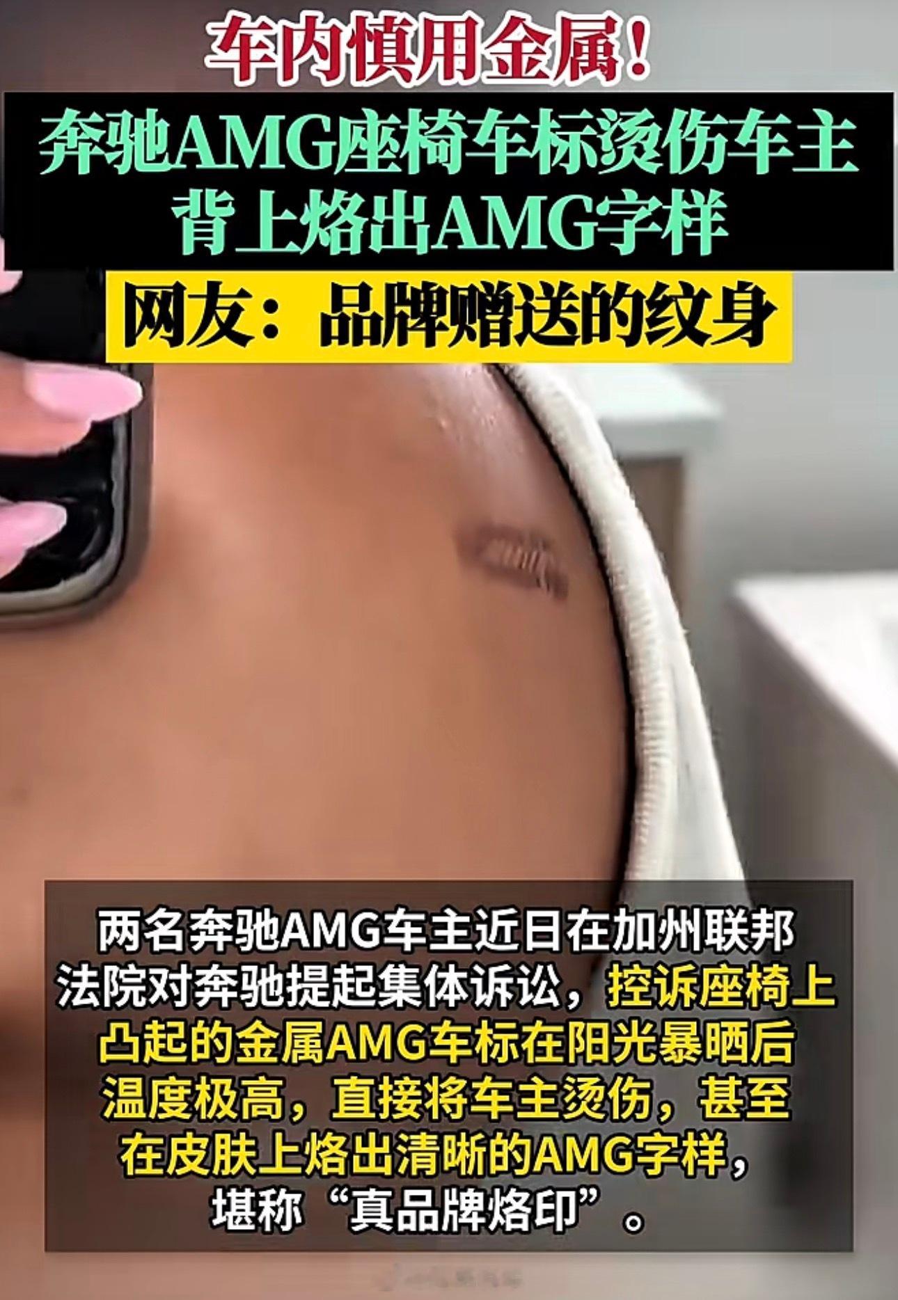 这着实没想到，不过建议没毛病，车企真的不要把金属标弄座椅上，夏天户外的车内你是不