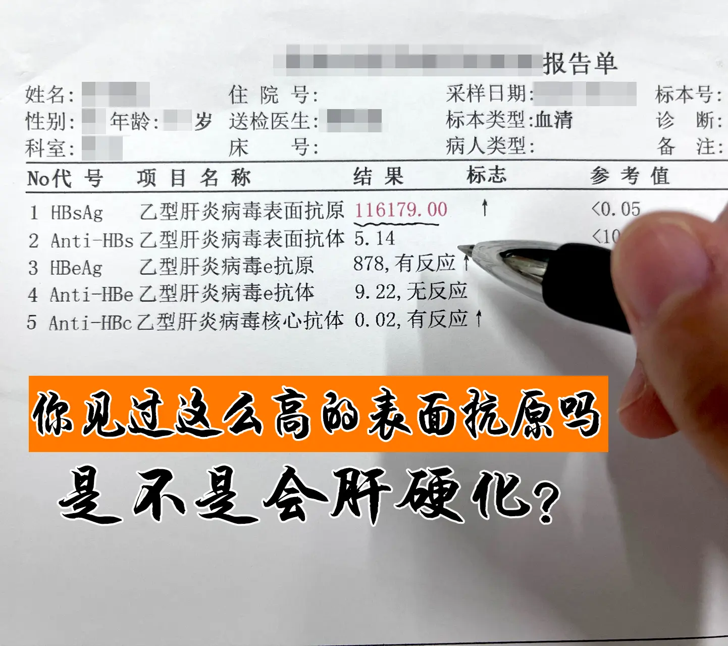 32岁的小伙体检时发现有乙肝，大三阳，表面抗原数值竟高达11万多，他满...